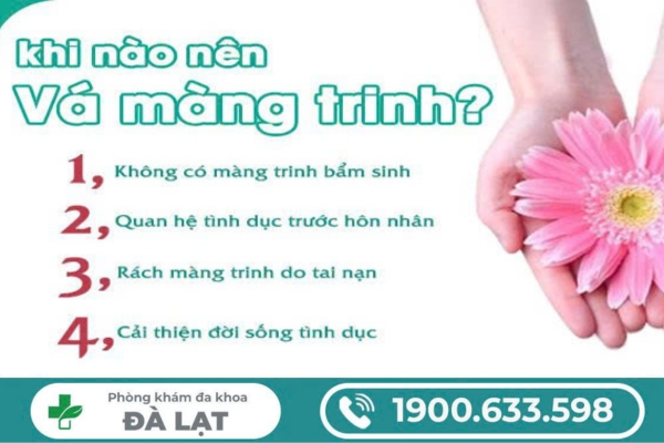 Hình ảnh minh họa